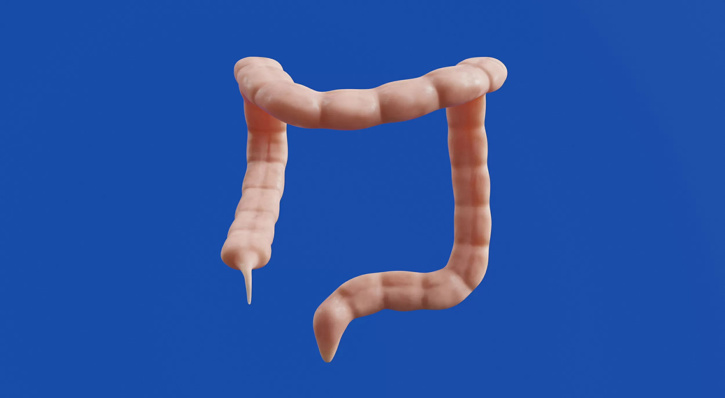 Irritable Bowel Syndrome (IBS): Common Triggers, Symptom Patterns, and Relief Strategies